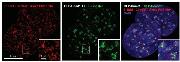 Fig. 2: Enhancement of GFP signal with GFP-Booster after EdU-Click-iT™ treatment. EdU-Click-iT™ treament leads to disruption of GFP signal. GFP-Booster labels GFP fusion proteins and thus reactivates and boosts the fluorescence.